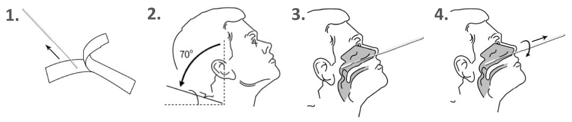 Clugene Test 1